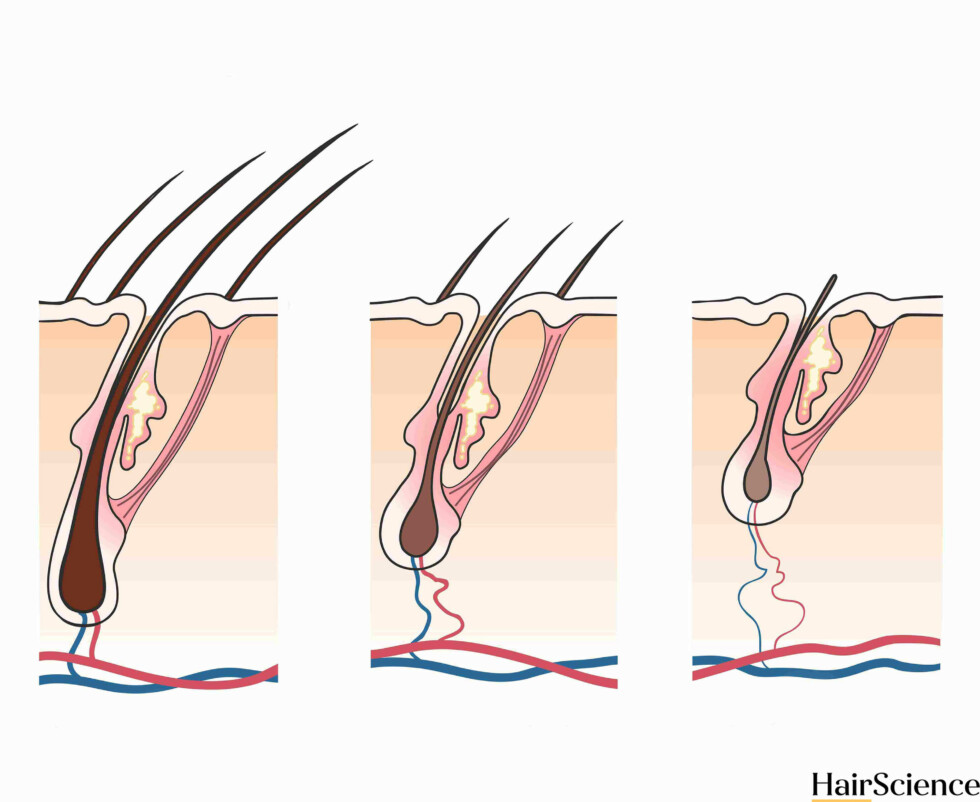Dry and brittle hair: causes and how to easily fix it