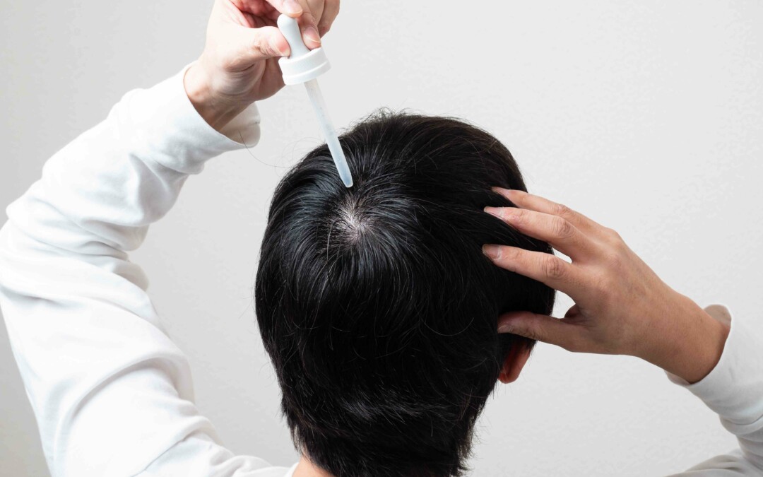 Kintor Advances With GT20029 Clinical Trials for Hair Loss