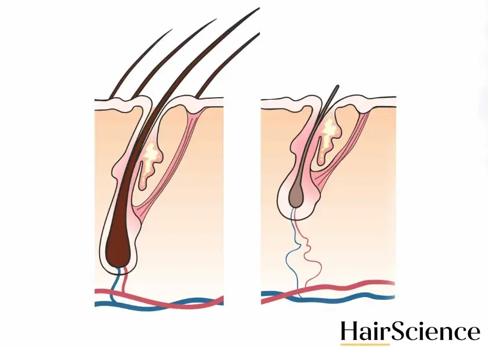 What’s the difference between vellus hair and terminal hair?